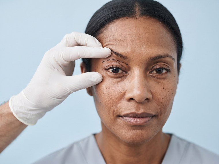 ¿Qué es la blefaroplastia?