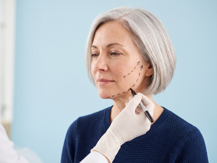¿Qué es el lifting facial?
