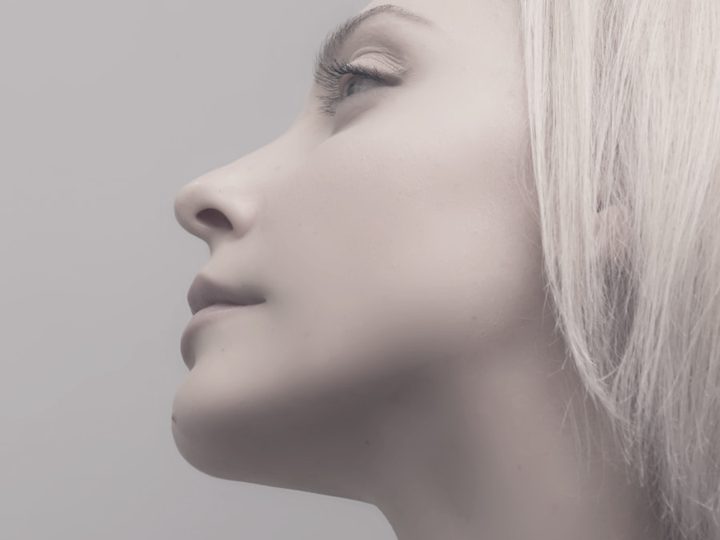 Rinoplastia